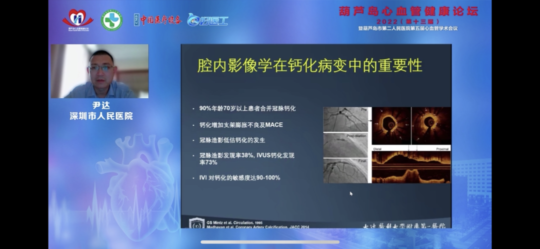 葫蘆島心血管健康論壇?2022｜創(chuàng)新驅(qū)動(dòng)發(fā)展，不斷提升心血管疾病救治能力(圖11)